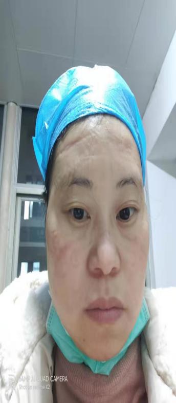 http://fsyy.jgsu.edu.cn/__local/A/37/A4/BAF62C0D8C4762B393F46421CCD_CF15F38A_10859E.png