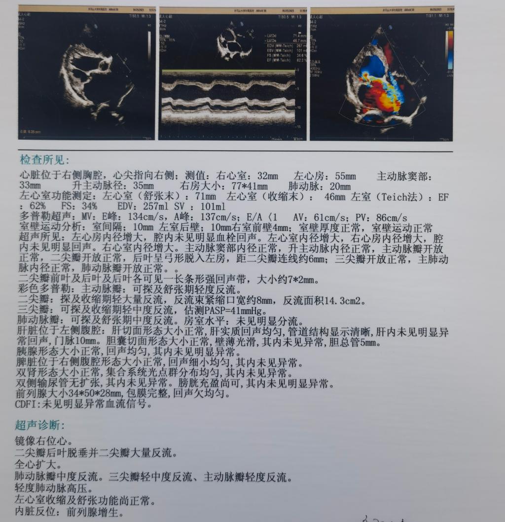 2725E